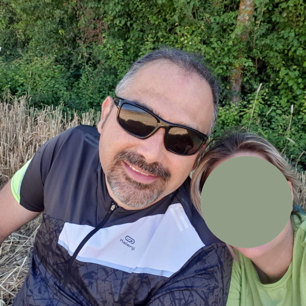 Caso ADF antes del trasplante capilar
